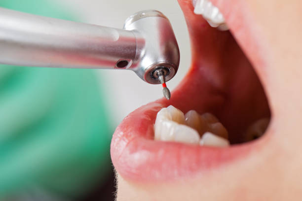 Best Cracked Tooth Emergency Dentist  in Somerton, AZ